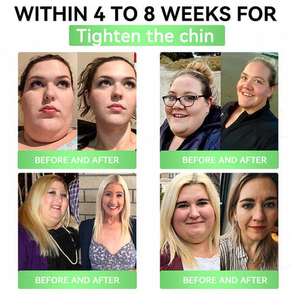 🧬Alcuras™ Moringa × Berberine × AMPK 8-Benefit Slimming & Metabolic Nano Microneedle Patch 🇺🇸  Just once a day · Visible changes in 7 days  ✅ For obesity, loose skin, diabetes, sleep apnea, joint issues, and more